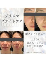 ビューティークリニックコダマ 日南店/☆プラズマブライトケア☆