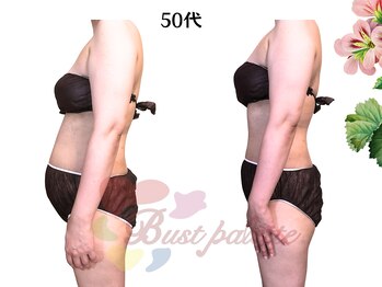 アンジェリークBB バストパレット本店/50代バストアップ★Be・Af