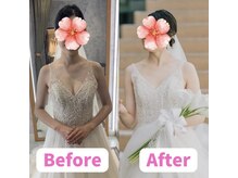 ボディキュア ブライダル美容整体 大阪梅田/【巻き肩改善】自然な立ち姿に