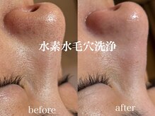 ネオリー(neorii)の雰囲気（水素水毛穴洗浄で毛穴レス◎いちご鼻・ざらつき　即実感！！）