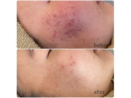 セラピー(therapy)の写真