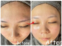 エレ(ele)の雰囲気（初めての方にも◎剥けないハーブで始める美肌♪）