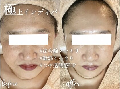 ソワンドビジュー(soin de bijew)の写真