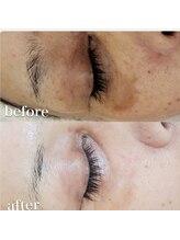 サロン ルポ(salon Repo)/目元シミケア美白