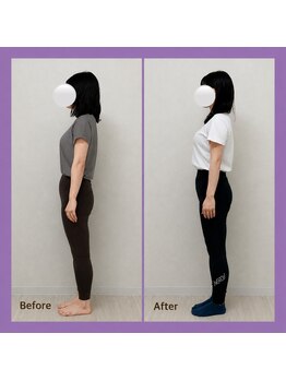 スイ(sui)/巻き肩・骨盤の歪み改善