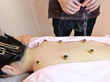 ヨウジョウ サロン ウェル 鴨池院(YOUJOU salon WELL)/優しい温灸でホッとリラックス