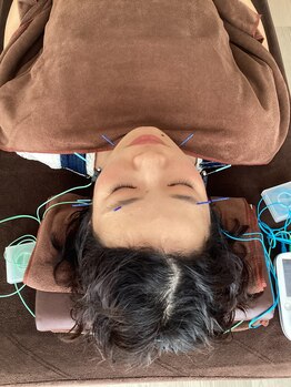 ハリファ鍼灸院 横浜関内院(HariFa鍼灸院)/美容施術/美容鍼