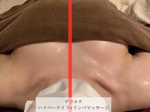 アージェム(AGEM)/【インディバ痩身】デコルテケア