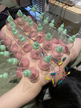 ウル(ulu)/カッピング