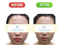 シンメトリー 熊本/むくみの原因は塩分取り過ぎ？