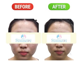 シンメトリー 熊本/むくみの原因は塩分取り過ぎ？