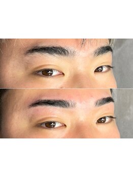 メンズフェイシャル