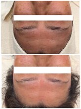 エアリアル 大川店/肌改善エステ