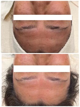 エアリアル 大川店/肌改善エステ