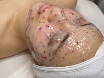 温活&美肌管理サロン su:su 福岡糟屋【よもぎ蒸し/毛穴/小顔/シミ/シワ】の写真/【毛穴の黒ずみ・開きを一掃】最新美肌管理でつるんとなめらか卵肌へ