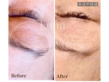 ルナ(Luna)の雰囲気（まぶたのお悩み、対応できます）