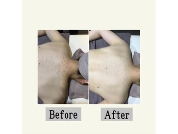 ペールノエル 沼津店(PERENOEL)/フォトエステ(20代女性)