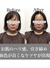 ハリサロンドオフ 心斎橋店(hari salon de off)/血の巡りが何より大事です！