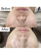 ウルル(ULuLu)/ビフォーアフター