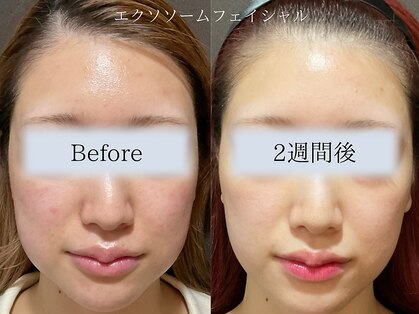 ビボーラ(BEBEAURA)の写真