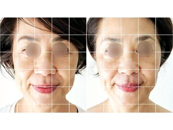 ディーバ 北浜(Diva)/スペシャル小顔コルギコース