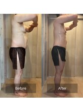 アリッチ 岡崎店(a.Rich)/痩せづらい二の腕もスッキリ！