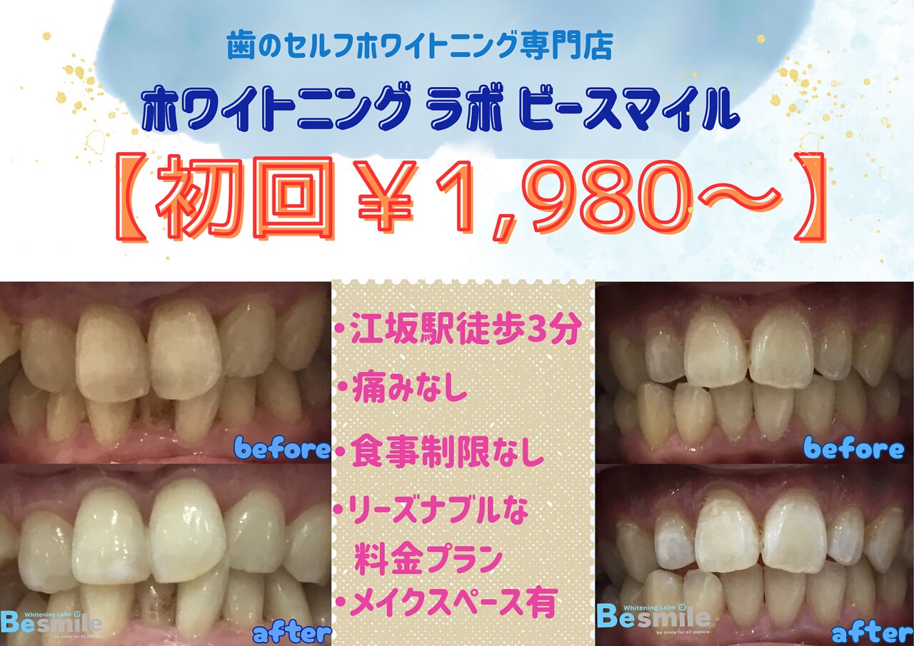 ホワイトニングラボ ビースマイル(WhiteningLabo Besmile