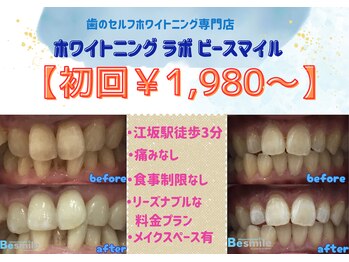 ホワイトニングラボ ビースマイル(WhiteningLabo Besmile)