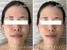 リフィール たまプラーザ店(refiel)の雰囲気(コラーゲン生成最大2倍!細胞レベルの違いをお試しください♪)