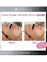 紡 つむぐ/ホワイトスノーピール変化