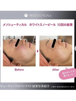 紡 つむぐ/ホワイトスノーピール変化