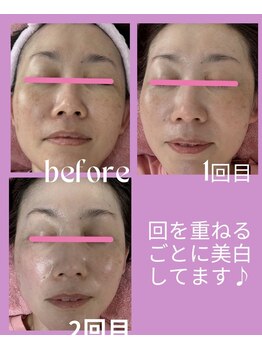 サロン ほほえむ(Fofo-m)/