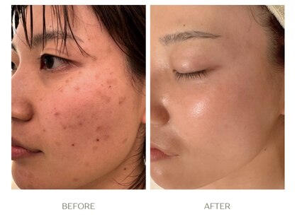 ラシェプリズ(LACHER PRISE)の写真