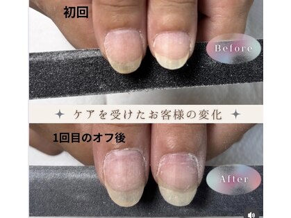 nailsalon NiJiの写真