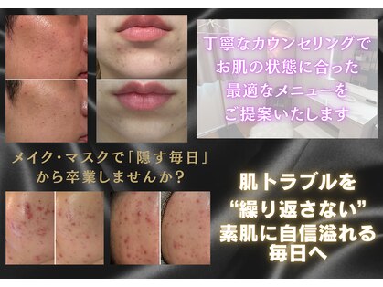バルディーナ(BALDINA)の写真