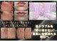 バルディーナ(BALDINA)の写真
