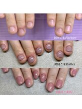 プライズアイリス アイラッシュ 池袋東口店(prize Iris eyelash)/深爪改善【池袋】