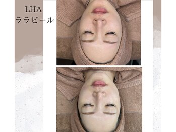 ベルーテ 田町三田(Bellute)/発光ツヤ肌★ララピール