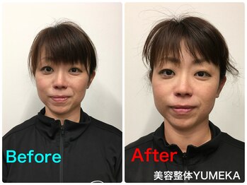美容整体ユメカ(美容整体YUMEKA)/小顔矯正でリフトアップ!