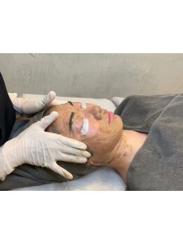 お肌をきれいにしたい