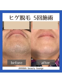 アマナ(AMANA)/若くなったと言われる方爆増中!