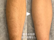 ヴィセラ(Vicella)/毛穴も目立たない！