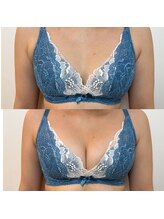 横に流れ気味の偏平型バスト