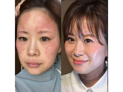 ベリッシマ(Bellissima)の写真