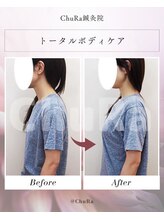 チュラ鍼灸院 西宮北口(ChuRa鍼灸院)/姿勢矯正