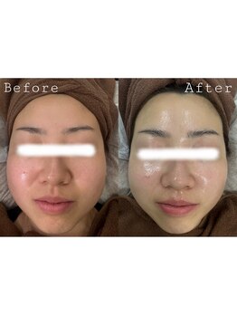 オアシス 一宮(Oasis)/しみ・くすみケア!透明感UP!