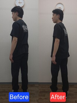 最後の整体 練馬駅前院/腰痛でお悩みの方の可動域