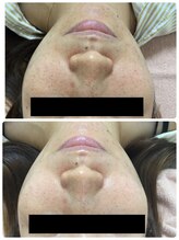 メイユール(MEILLEUR)/