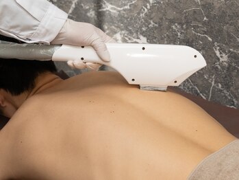 メンズ シンバ(SIMBA)/【背中脱毛】