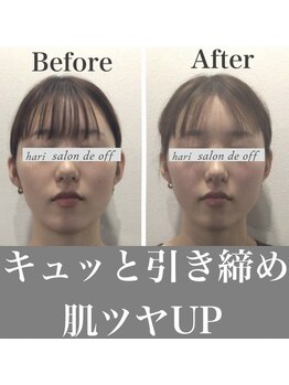 ハリサロンドオフ 心斎橋店(hari salon de off)/引き締め効果抜群◎